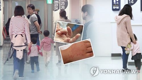 영유아 수족구병 유행…"회복 전 어린이집 등원 금물"