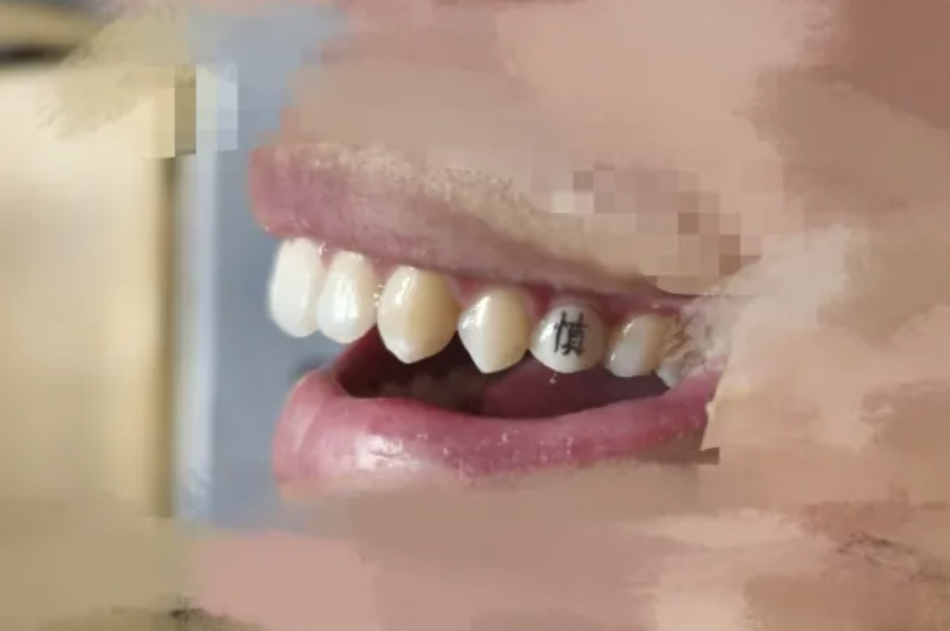 온라인카지노 불법 벳무브