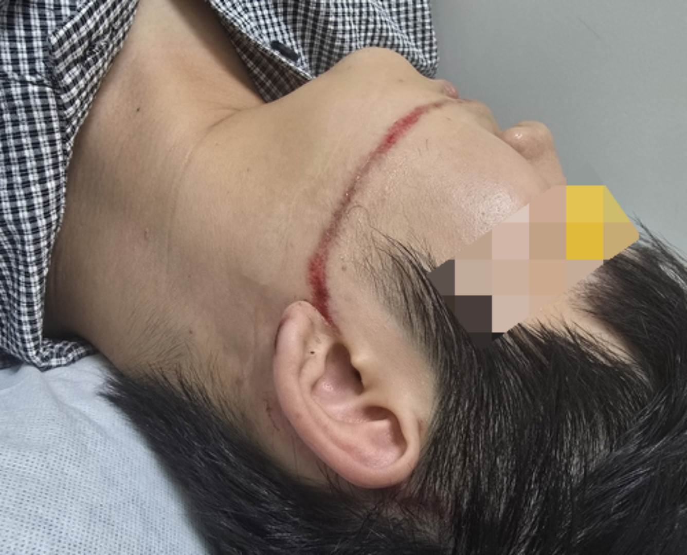 물 축제서 워터건 고압수 맞은 대학생…안산시·축제업체 고소