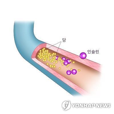 당뇨환자 10명 중 3명은 혈당 관리 '사각지대'…123만명 달해