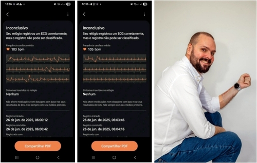 "갤워치 덕에 심장마비 온라인카지노 경찰 벳무브" 브라질 남성 '구사일생'