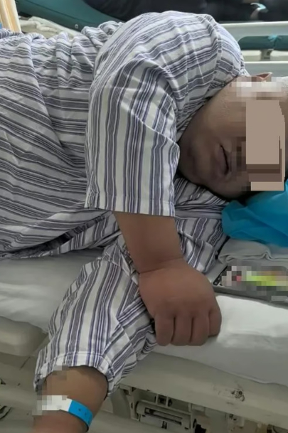 여친 부모에 잘 보이려다…위 우회술 받은 134kg 중국 남성 메이저카지노사이트