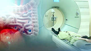 <em class='find'해외 온라인카지노 벳위즈</em 치료제 후보물질 개발…내년 말 임상실험