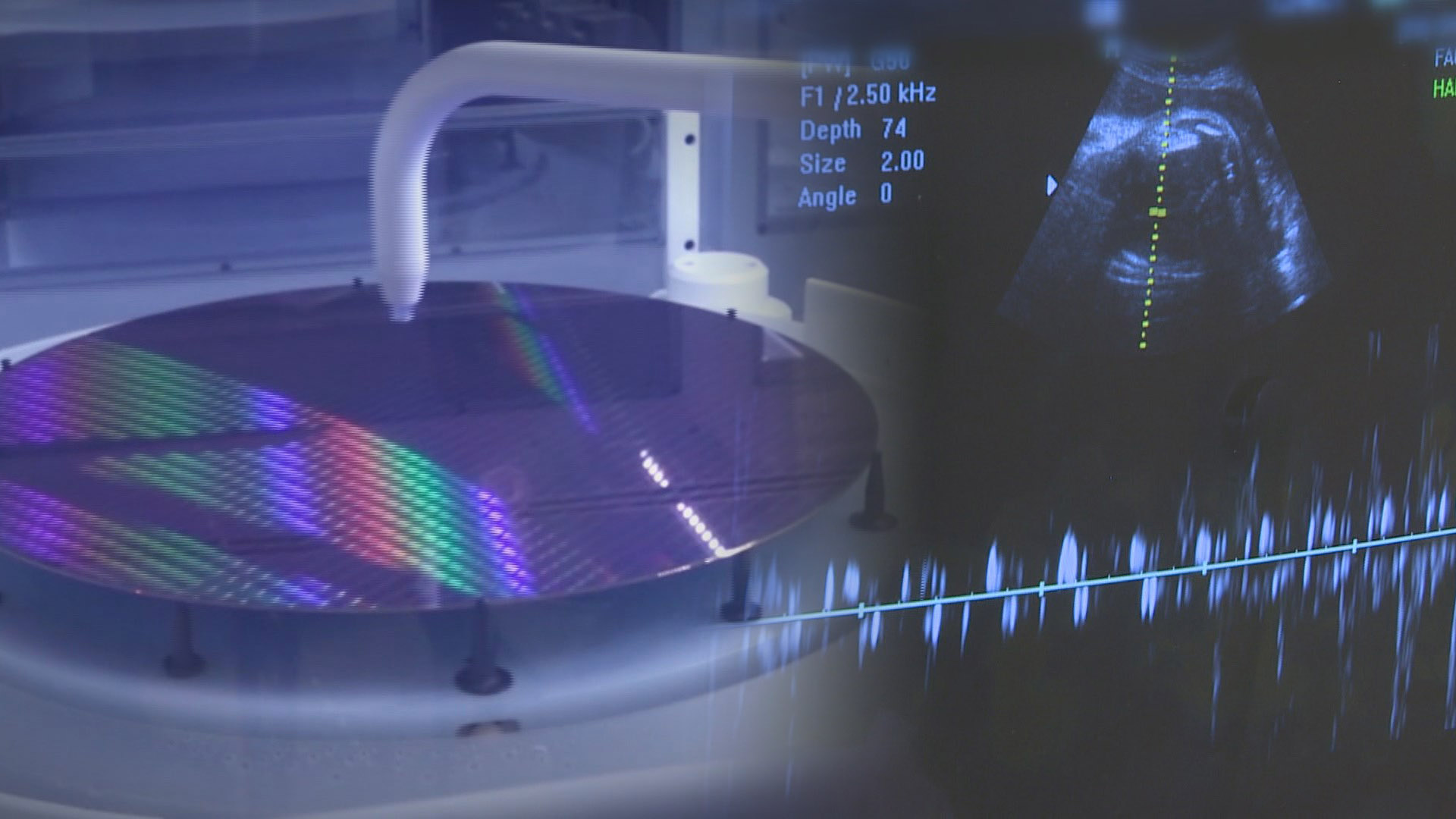 반도체공장 근로자 태아 산재 첫 온라인카지노 실시간…"인과관계 있어"