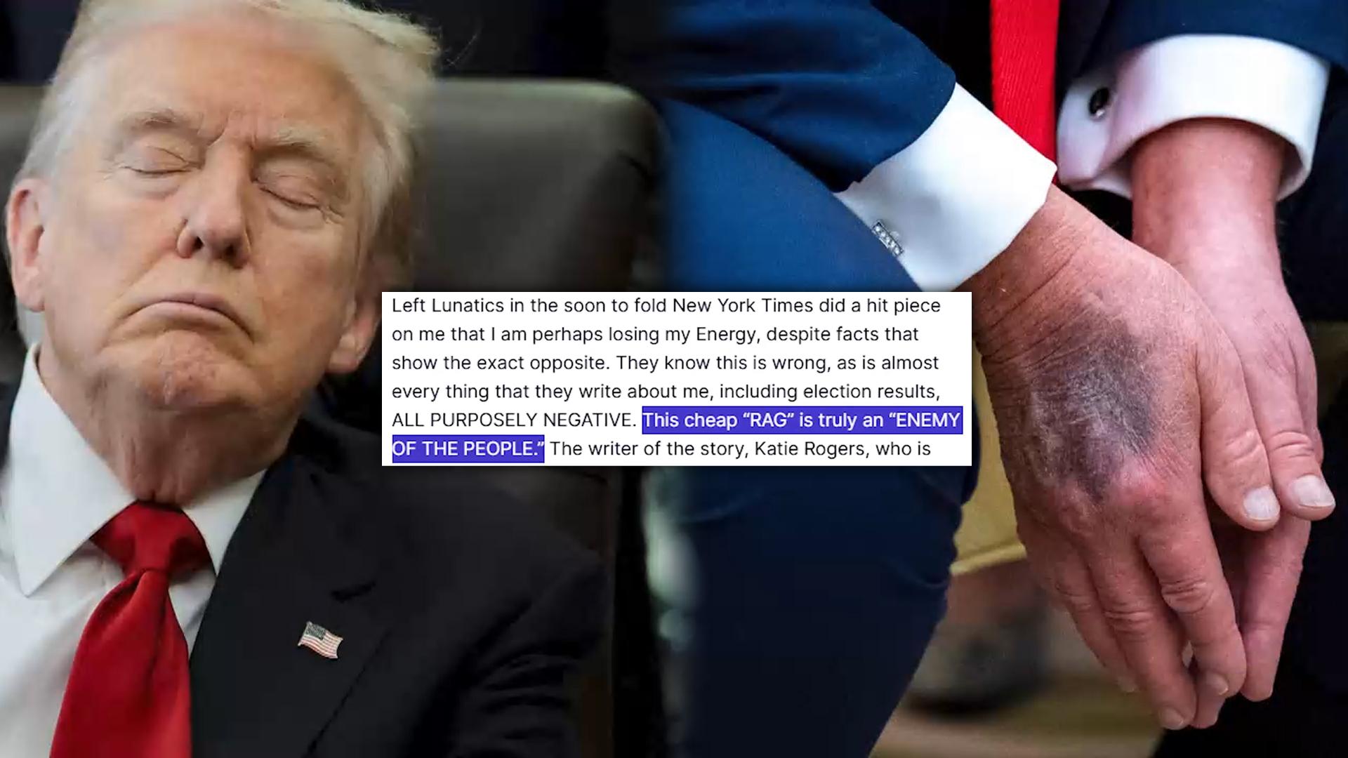 트럼프 또 '안전한 온라인카지노 리스크' 논란…"내가 노화?" 격노