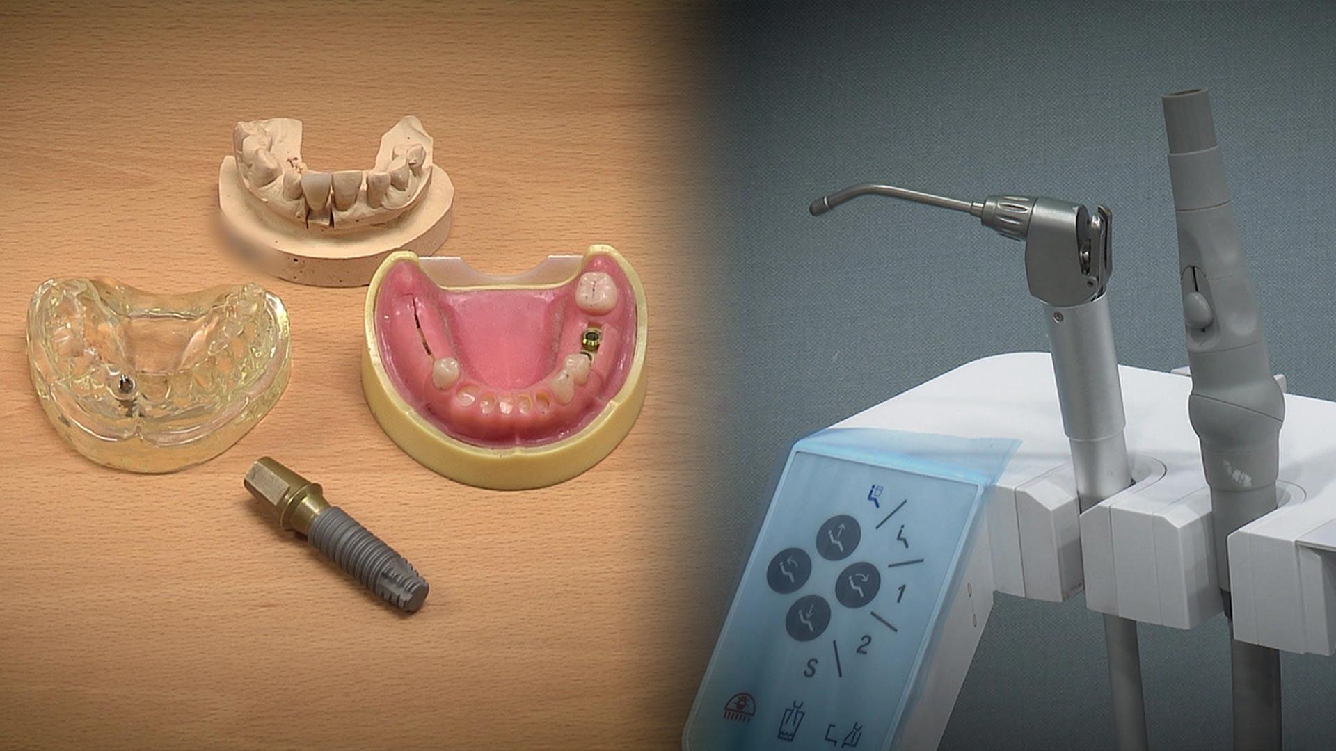 "임플란트 덜컥 결제했다가"…치과 <em class='find'선납진온라인카지노 라이센스 벳엔드</em 분쟁 급증