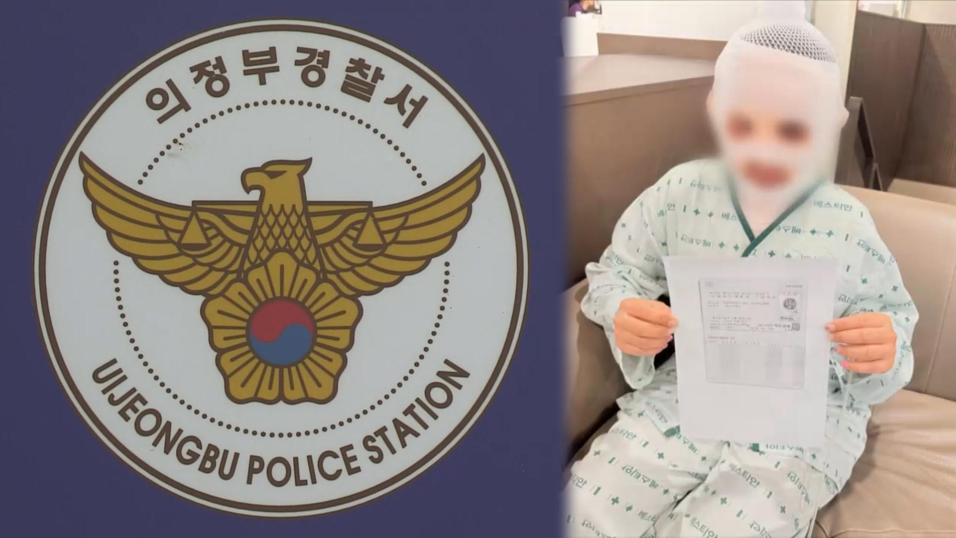 태국인 아내에 끓는 물 부은 남편…안전한온라인카지노서 "실수"