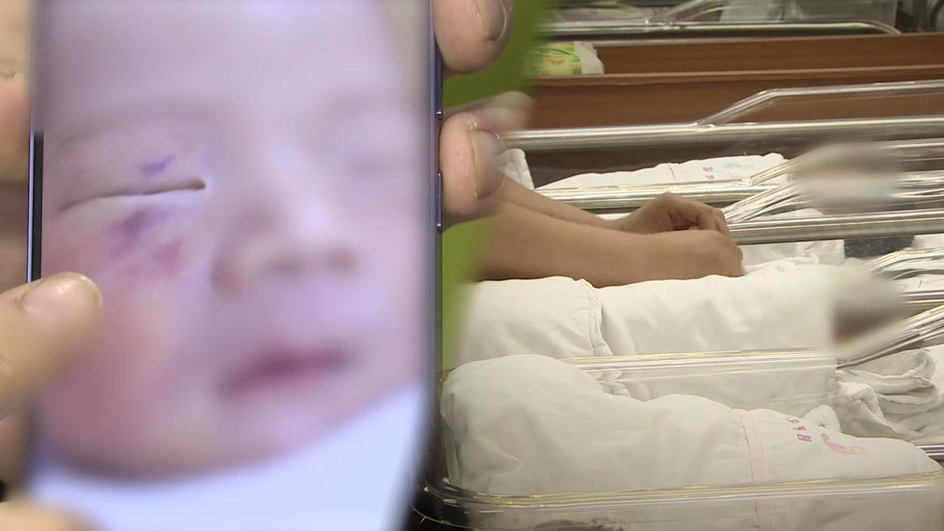 '생후 4일' 영아 얼굴에 상처?…CCTV 없는 신생아실